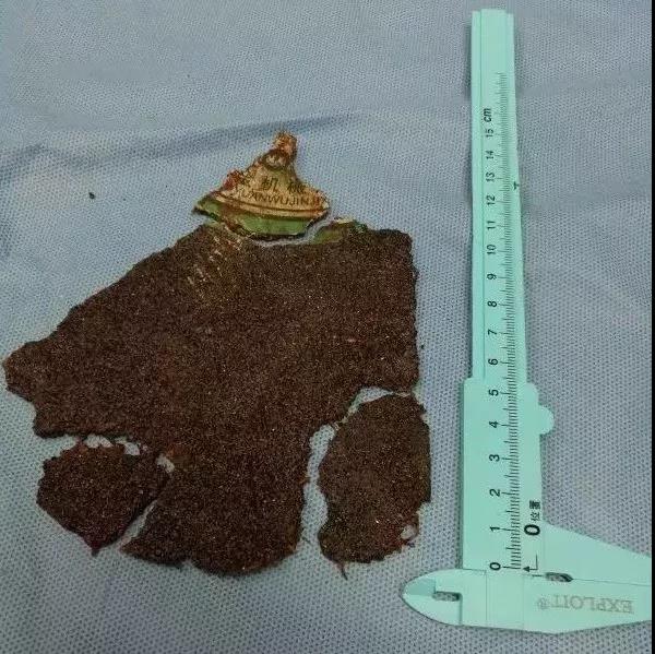 当场死亡！又是砂轮机事故：不装防护罩的砂轮机就是杀人机！石材行业注意防护！